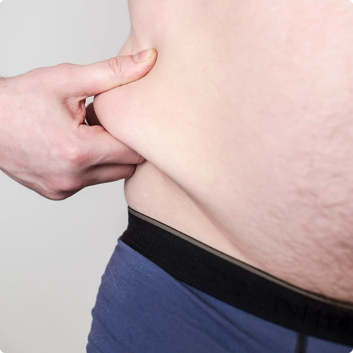 Over weight person TRT Diagnosed